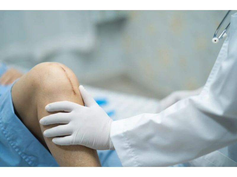 Knee Arthroscopy