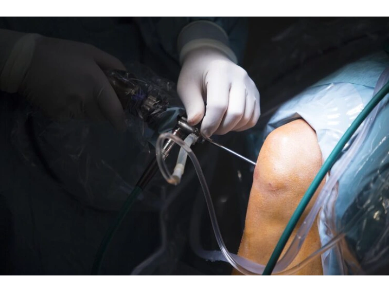 Meniscus Surgeries