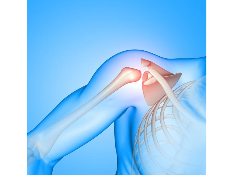 Shoulder Arthroscopy