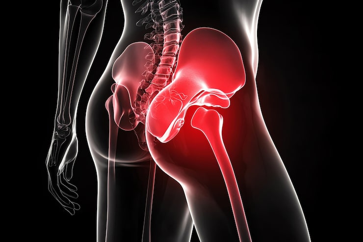 Pelvic and Complex Trauma